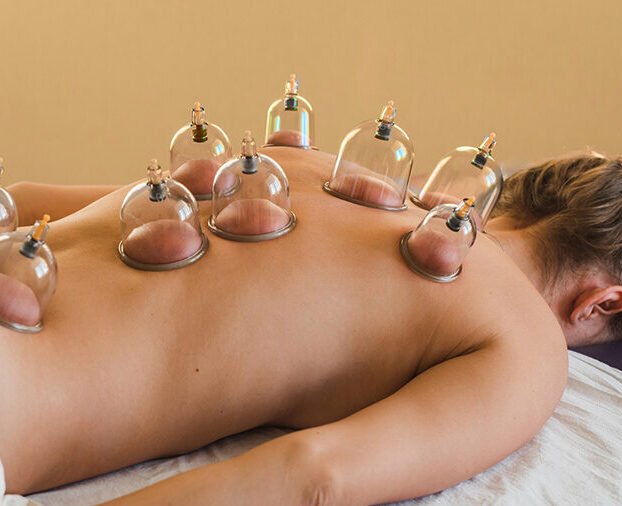 Cupping_Therapy