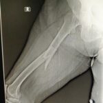 orthopedic surgery