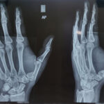 advanced dignostic tool orthopaedic x-ray